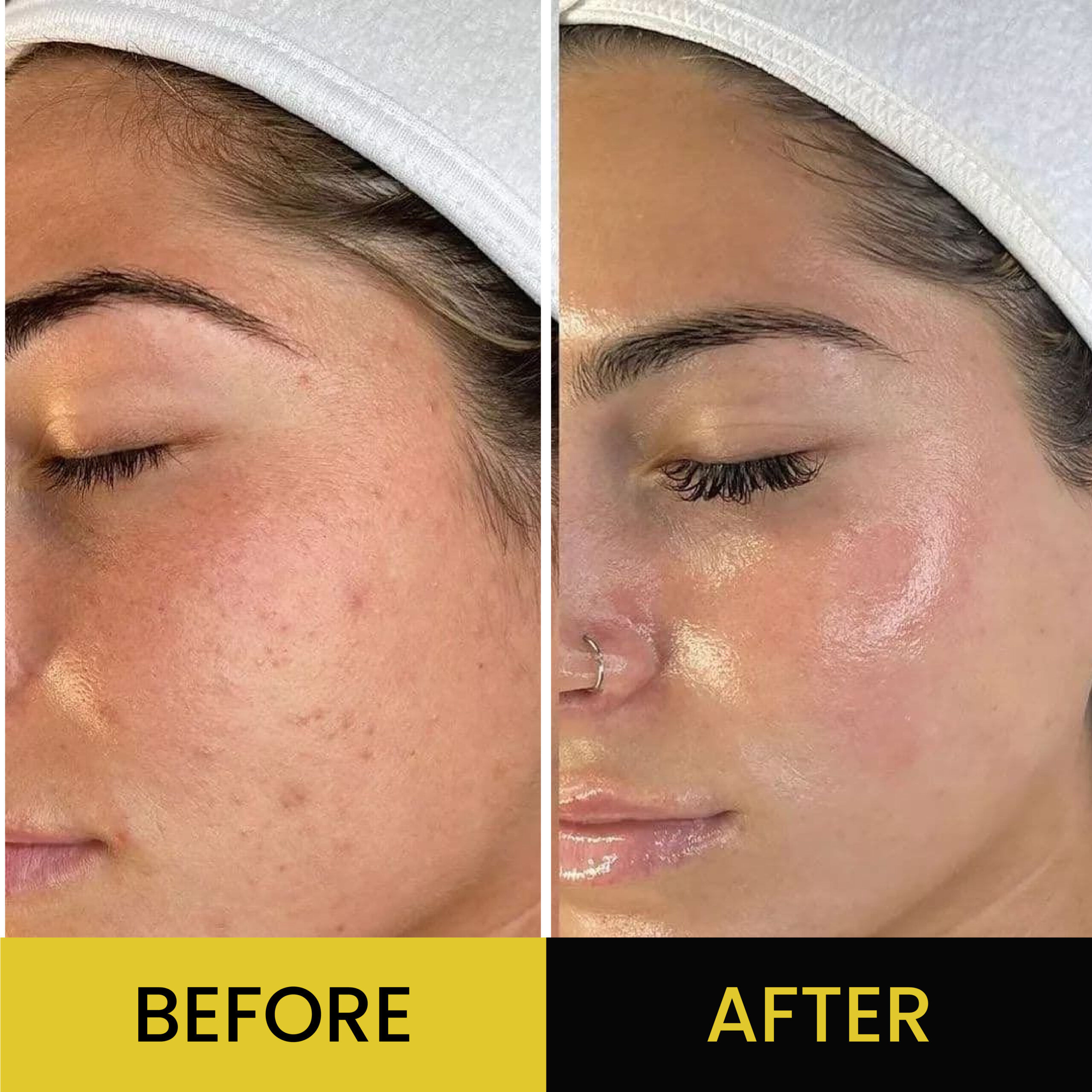 L-Glutathione Serum - Image 2